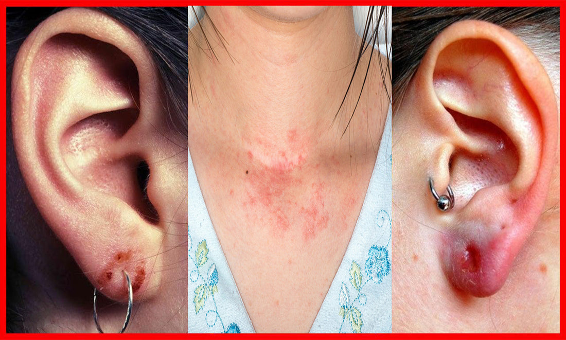 Hypoallergenic Jewelry Materials for Sensitive Skin